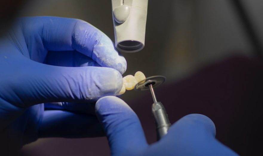 В Херсоне «ждуны» сдали СБУ лечивших весь город стоматологов