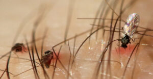 Что делать при укусе мошки